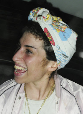 Amy Winehouse Missing Teeth