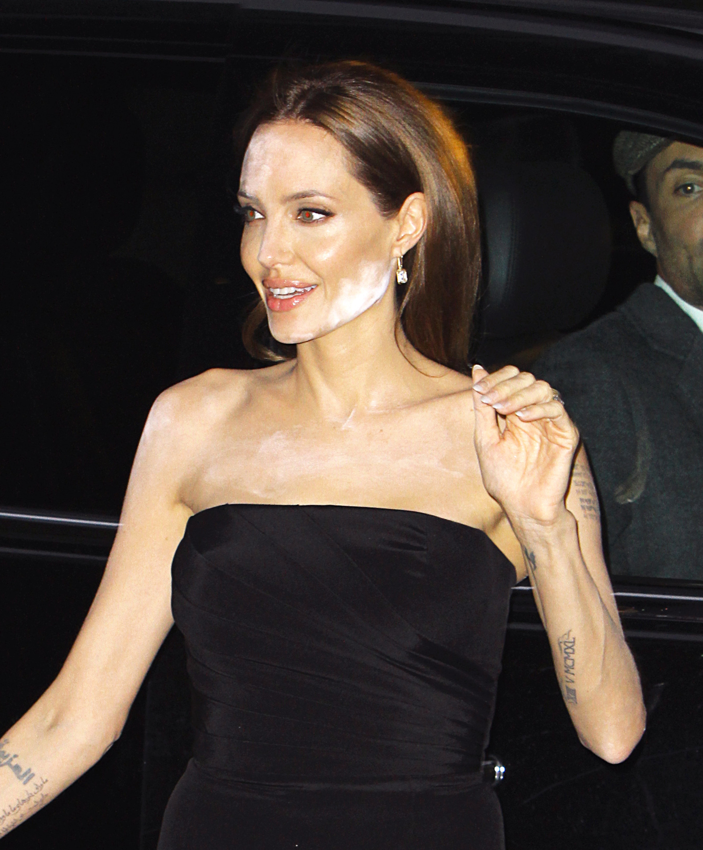 angelina jolie acne scars