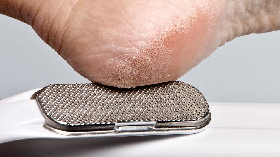 Using Cheese grater or callus shaver can do serious damage, not to