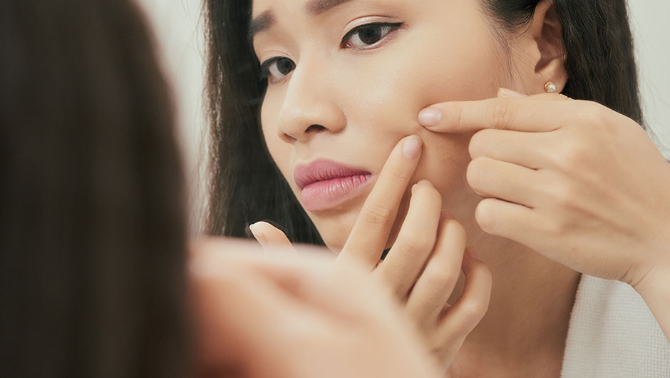 the-right-way-to-pop-a-pimple-according-to-a-dermatologist-shefinds