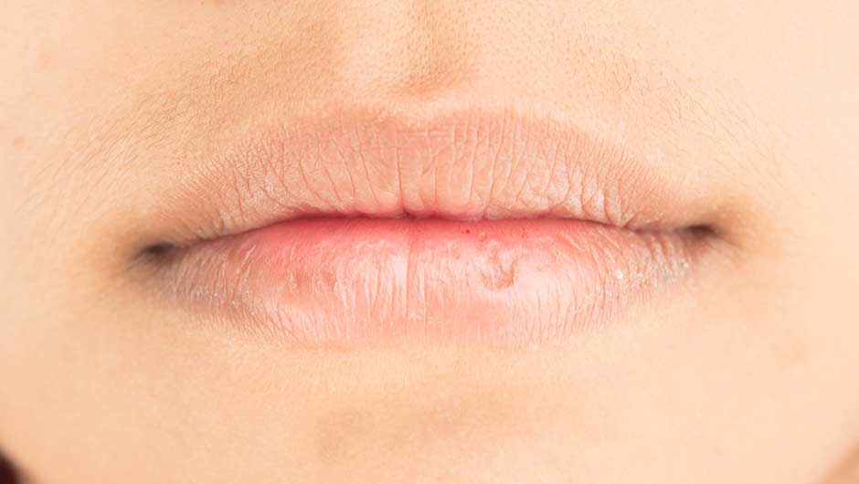 The One Chapstick That Actually Dries Out Your Lips, According To A ...