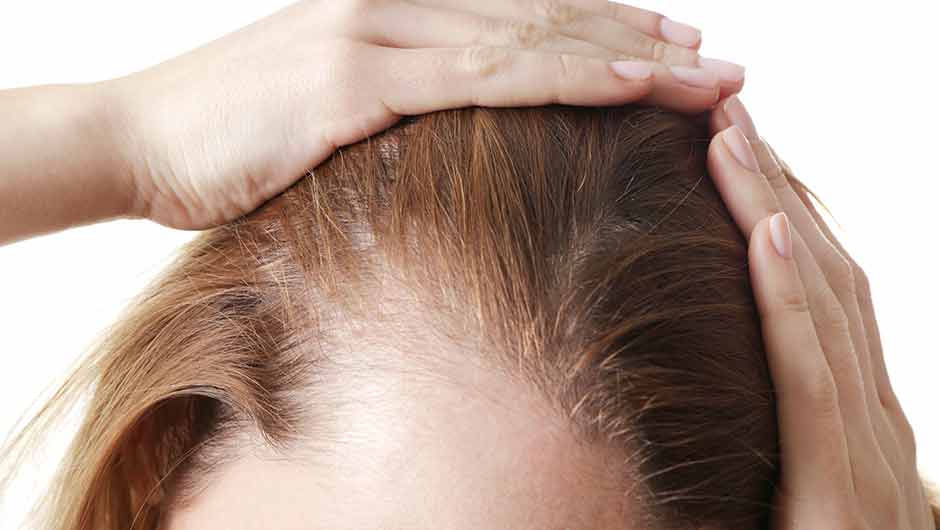 anti-inflammatory-foods-for-hair-loss-shefinds