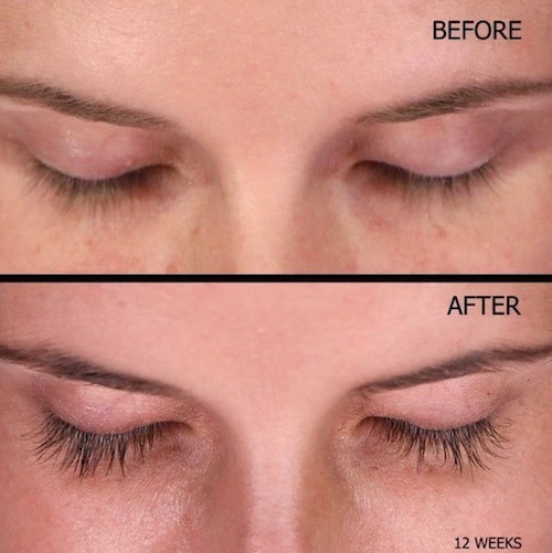 This Eyelash And Eyebrow Enhancer Serum Works In Just 4 Weeks–See The ...