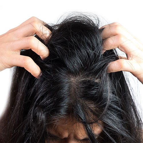 scary downside hair loss growth treatments