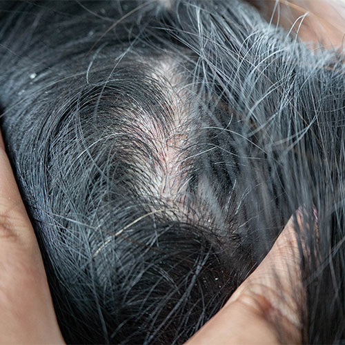 scary downside hair loss growth treatments