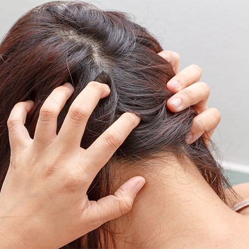 scary downside hair loss growth treatments