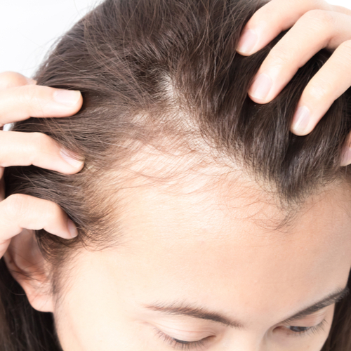 woman touching scalp