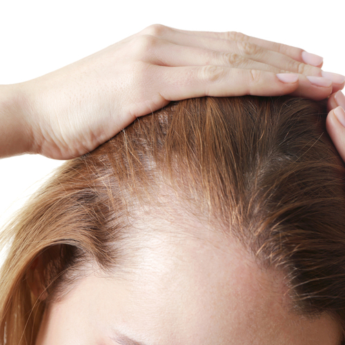 woman touching scalp