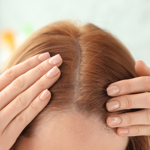 woman touching head