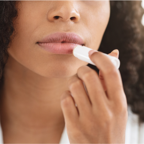 woman with chapped lips