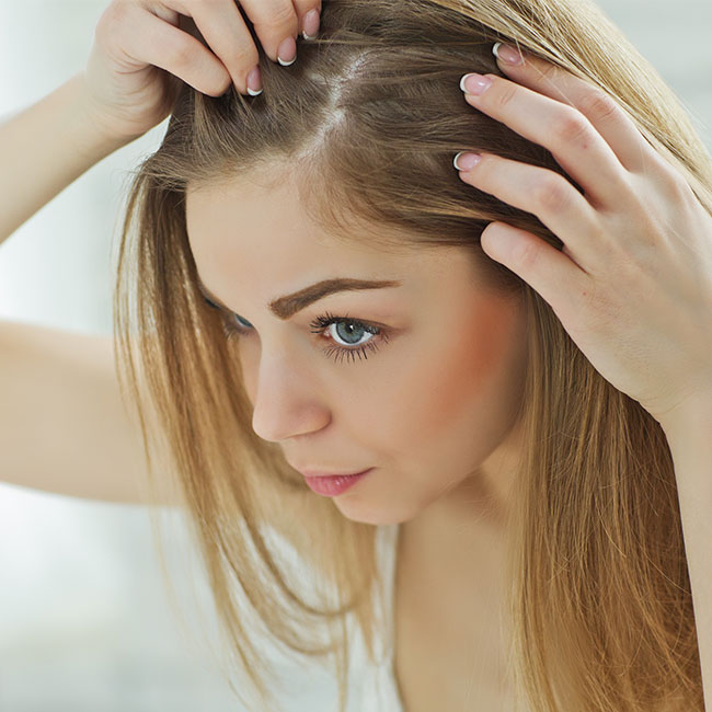 product causes dandruff