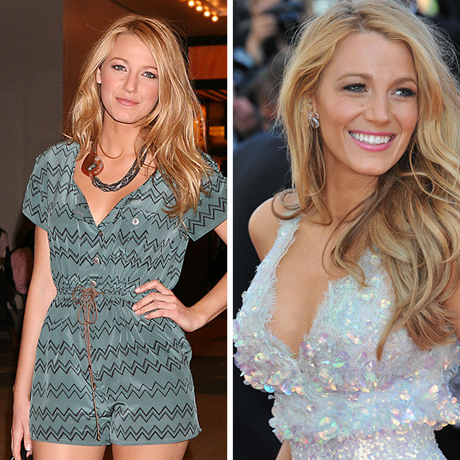 Blake Lively Doesn't Even Look Like Herself Anymore—Her Face Has Changed SO  Much - SHEfinds
