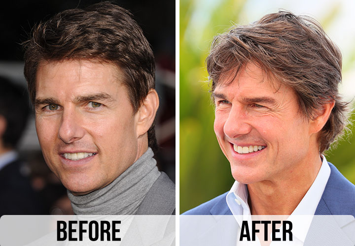 Fans Think Tom Cruise Had Plastic Surgery After Seeing These Before And ...