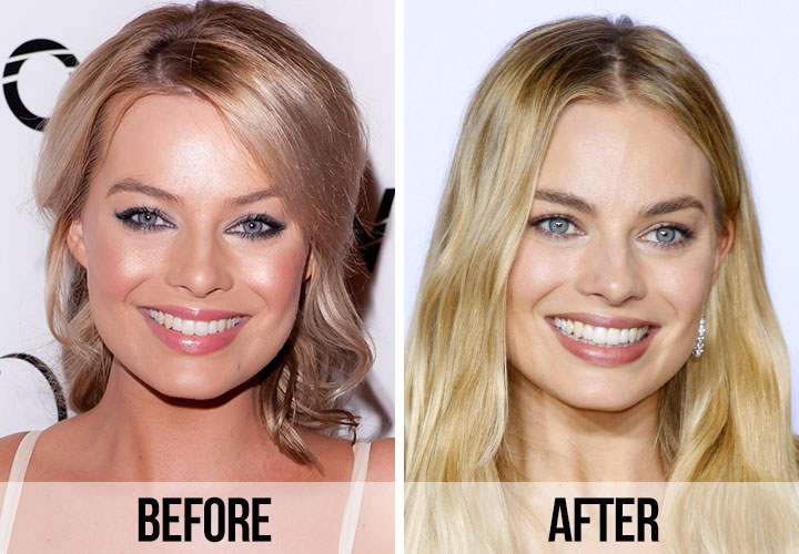 Fans Spot A ‘huge Difference In Margot Robbies Appearance After Looking At Before And After