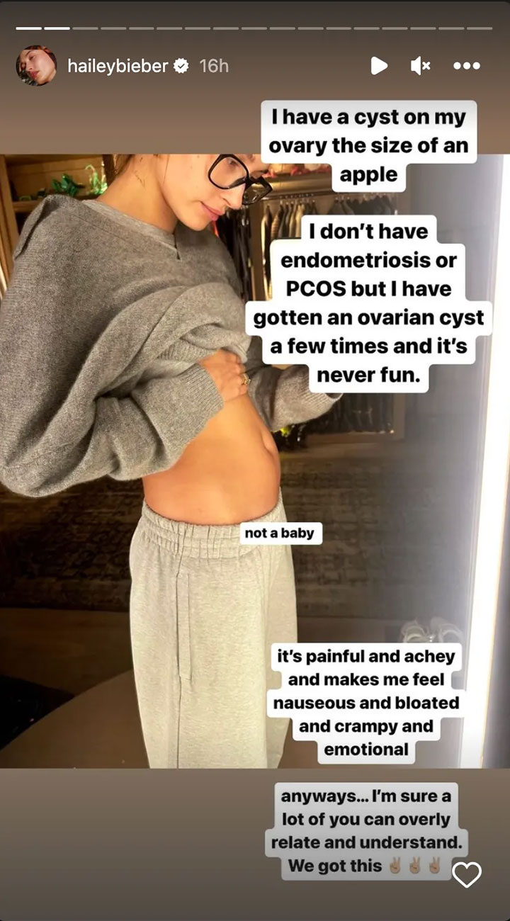 Hailey Bieber Instagram Story ovarian cyst