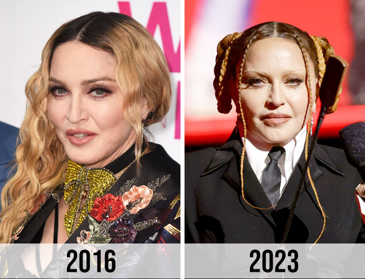 Madonna Looks 'Unrecognizable' Now—A Plastic Surgeon Weighs In