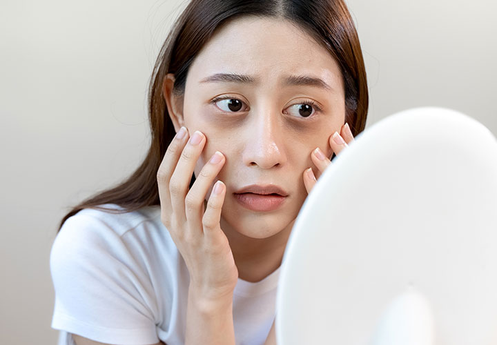 How To Get Rid Of Puffy Eyes? – Sonage Skincare