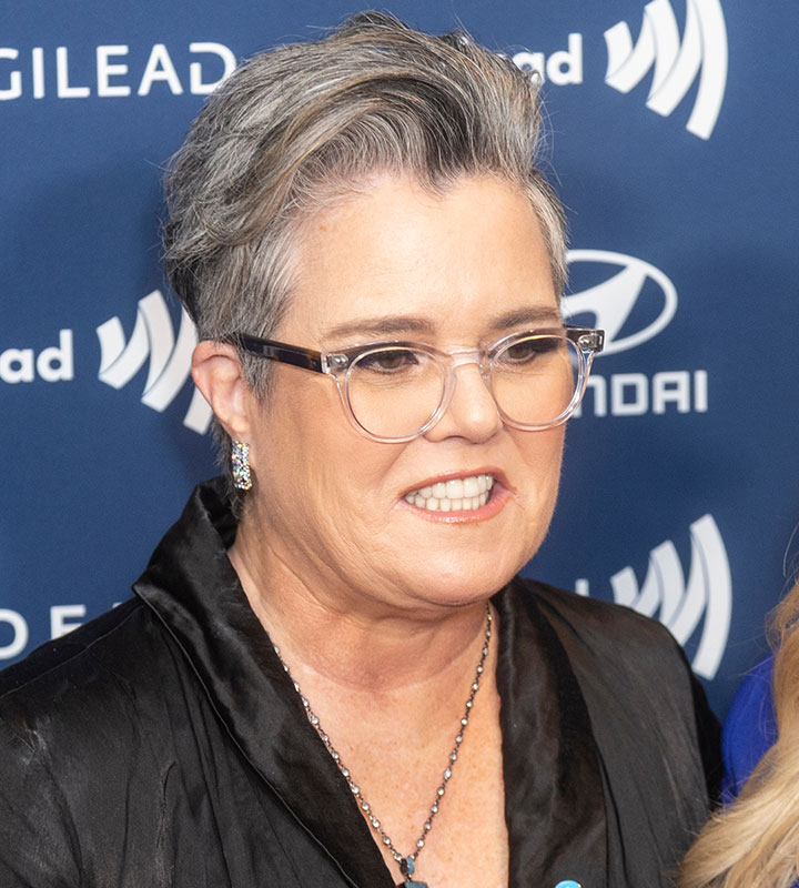 Rosie O'Donnell hair loss