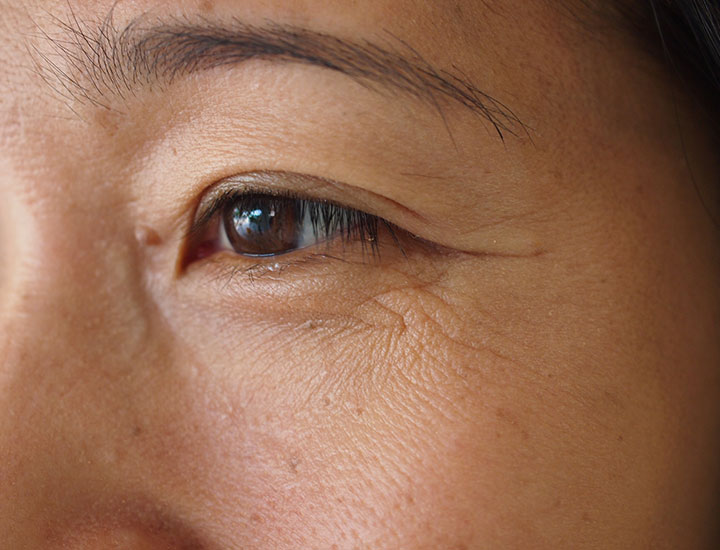 https://www.shefinds.com/files/2023/03/closeup-of-eye-wrinkles.jpg