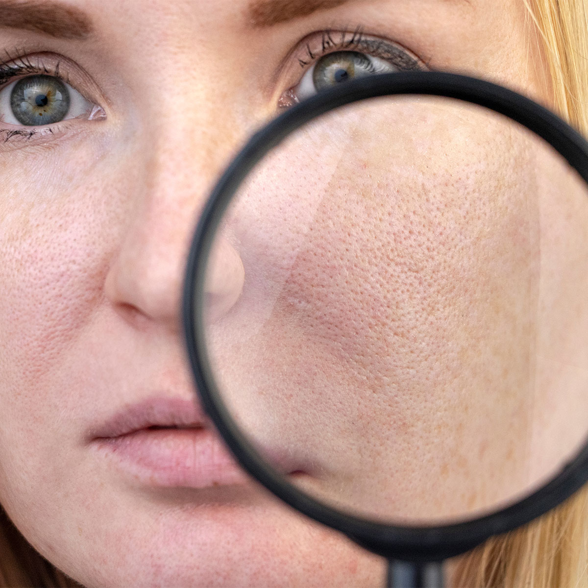 magnifying-glass-viewing-pores