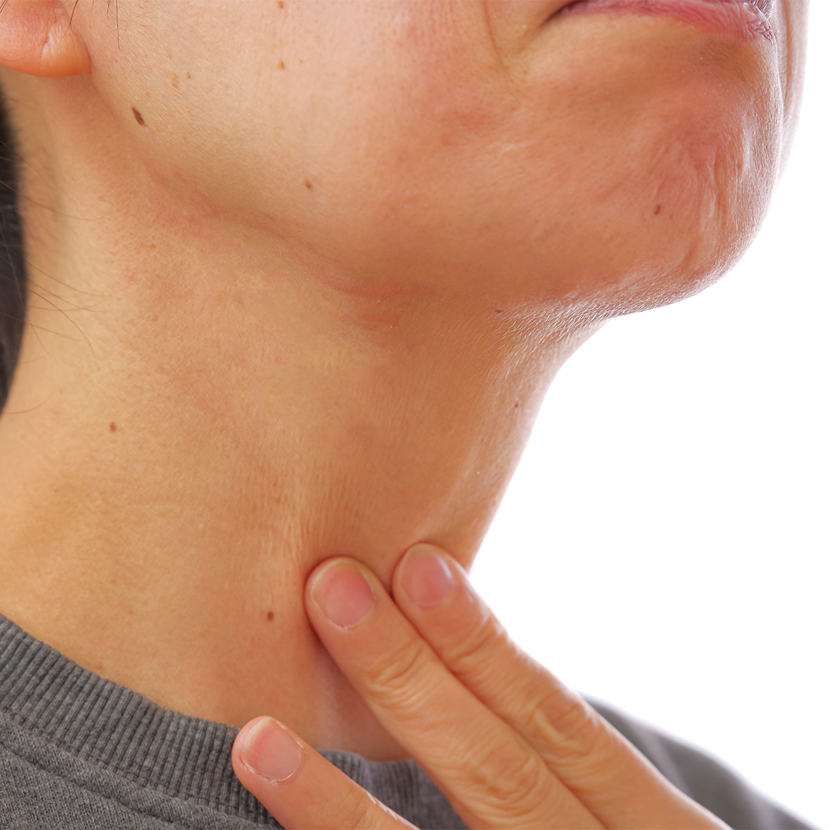 woman touching her neck with fingers, wrinkled skin on neck white background