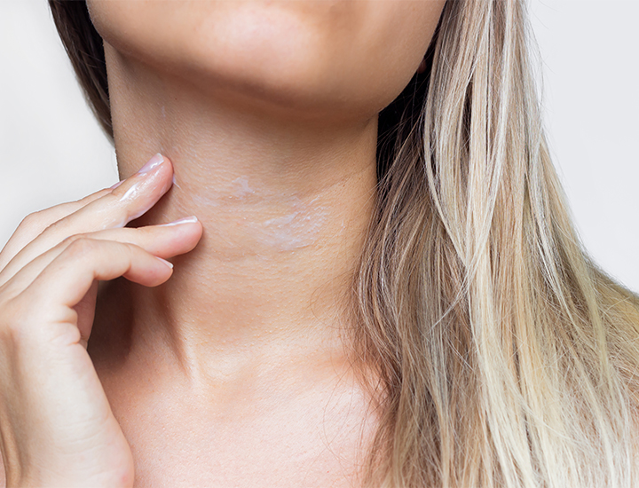 woman applying moisturizing white cosmetic skincare cream to neck with fingers