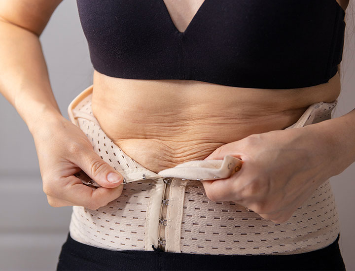 Woman struggling to put on waist trainer