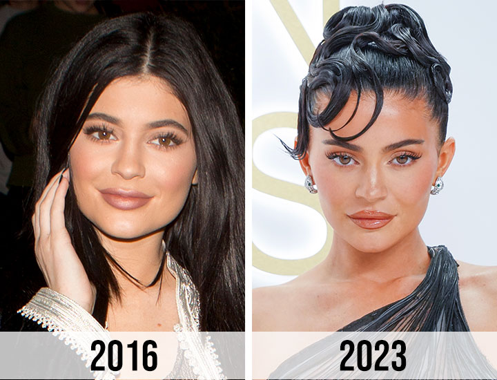 Rumor Has It: Did Kylie Jenner Get Breast Implants? - NewBeauty