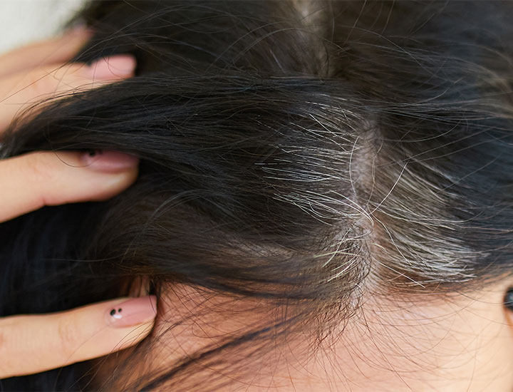 woman revealing gray hairs at scalp young age