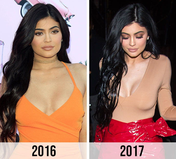 Total Transformation! See The Eye-Popping Evolution Of Kylie Jenner's Boobs