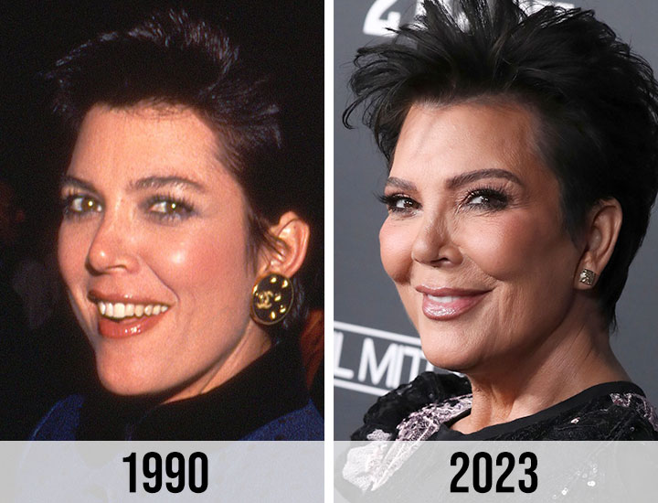 https://www.shefinds.com/files/2023/11/Kris-Jenner-before-after-1990-2023.jpg