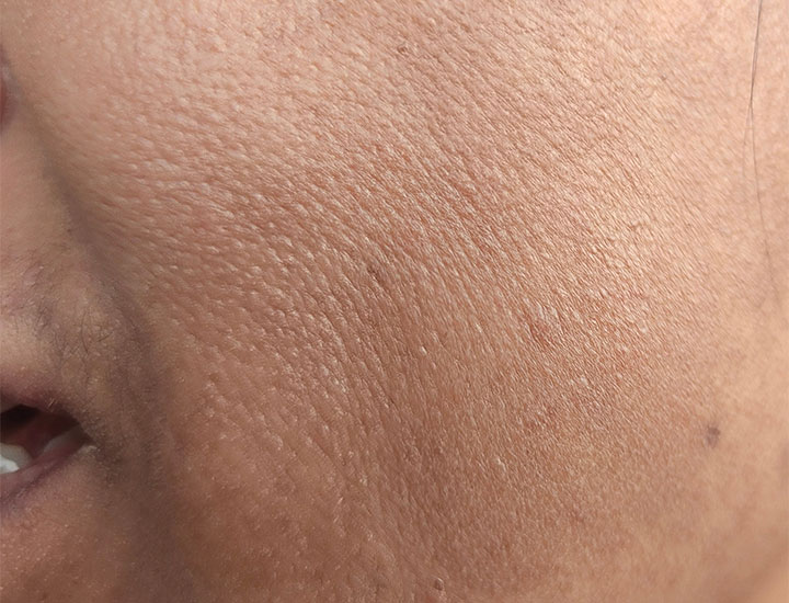 skin-texture