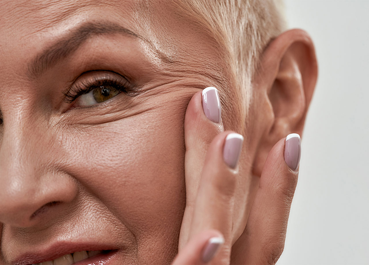 woman-facial-wrinkles