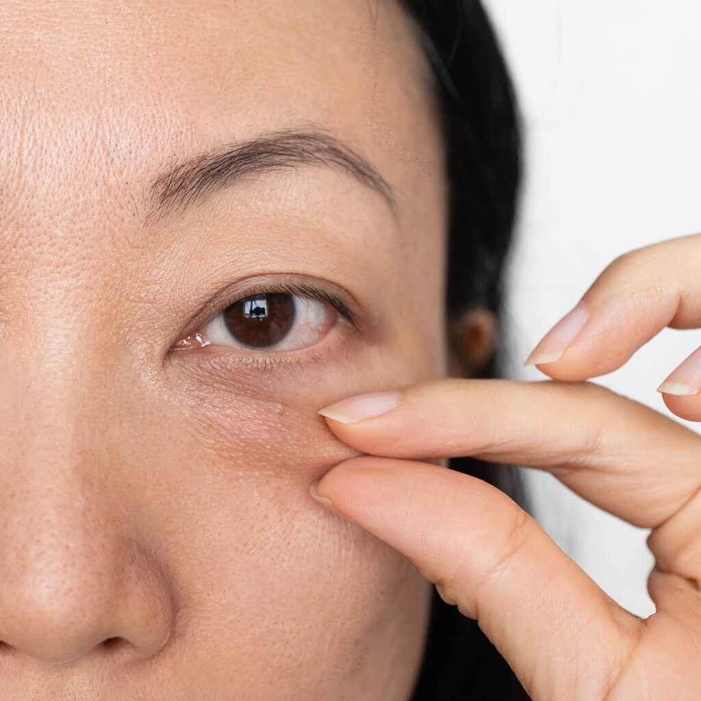 Dark Circles? Eat These 5 Foods & Flaunt Your Eyes Naturally