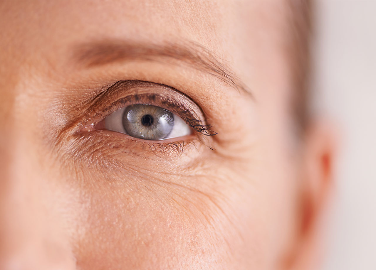 closeup-woman-eye-wrinkles