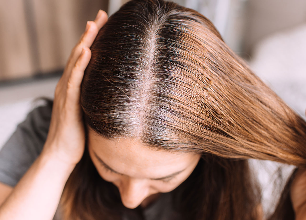 woman-hair-roots