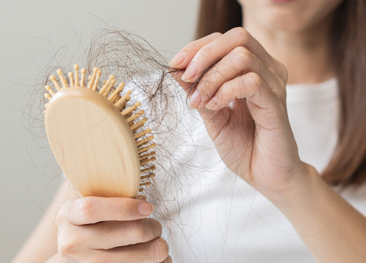 woman-losing-hair-in-brush