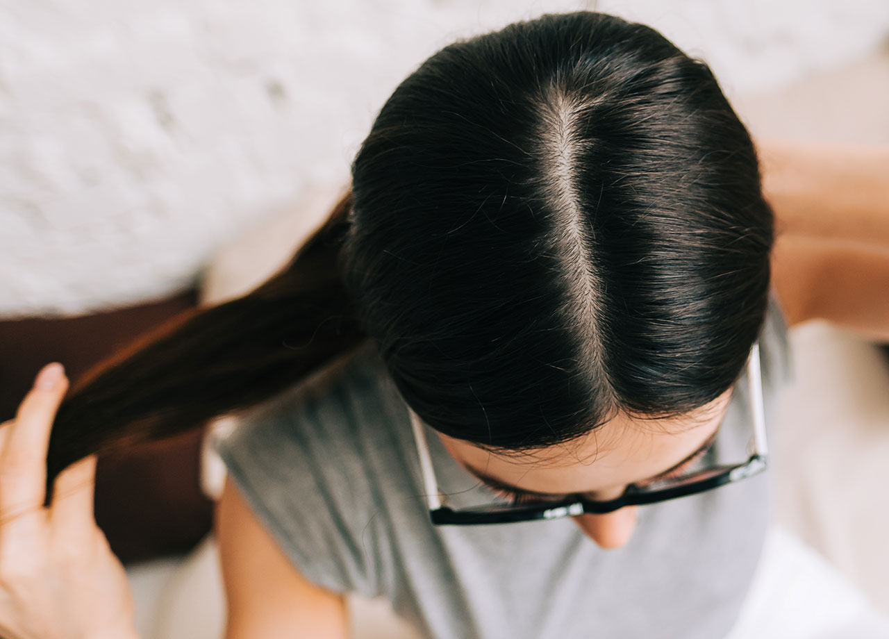 woman-scalp-no-grey-hair