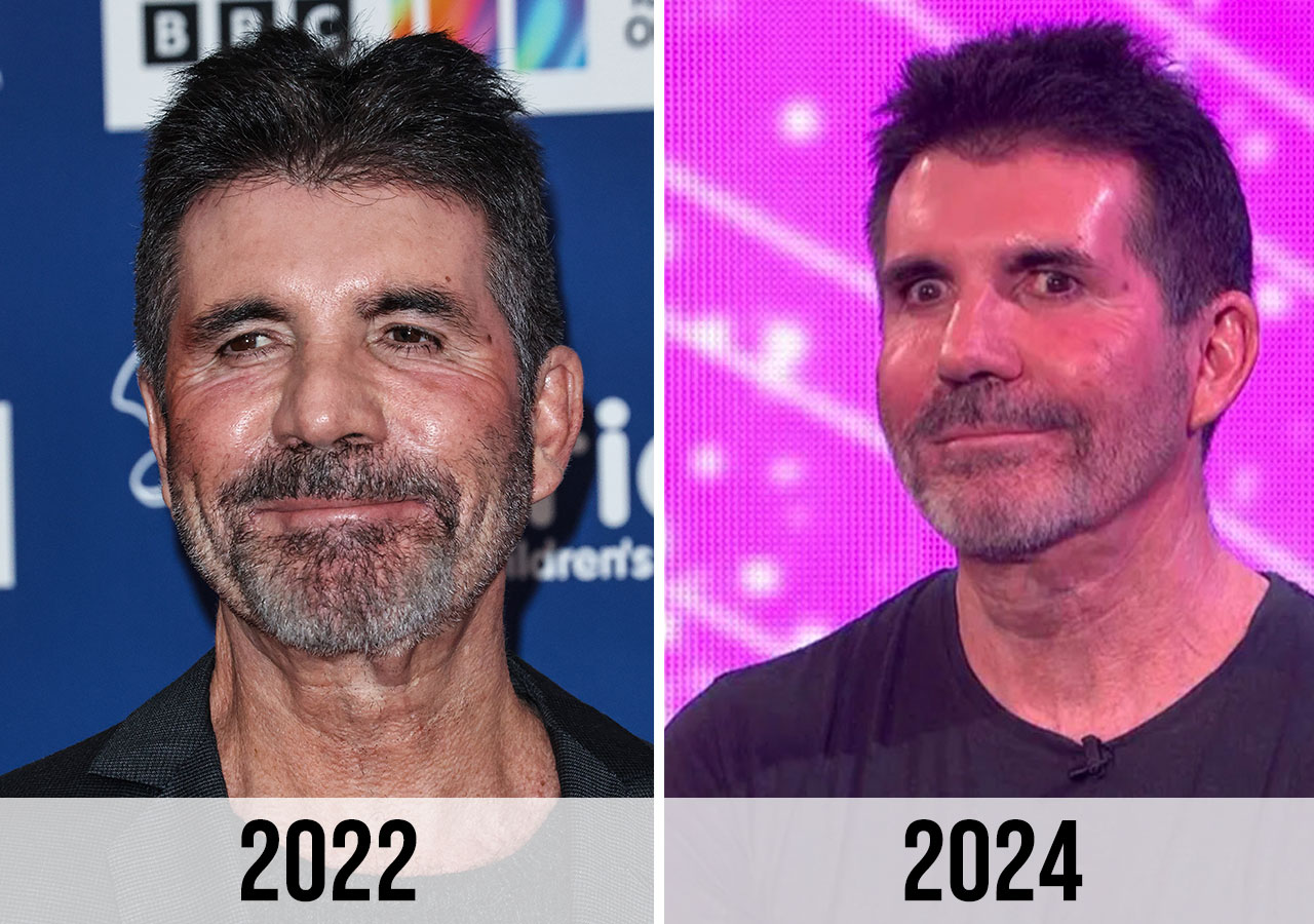 Fans Say Simon Cowell ‘Doesn’t Look Like Himself’ After His Appearance