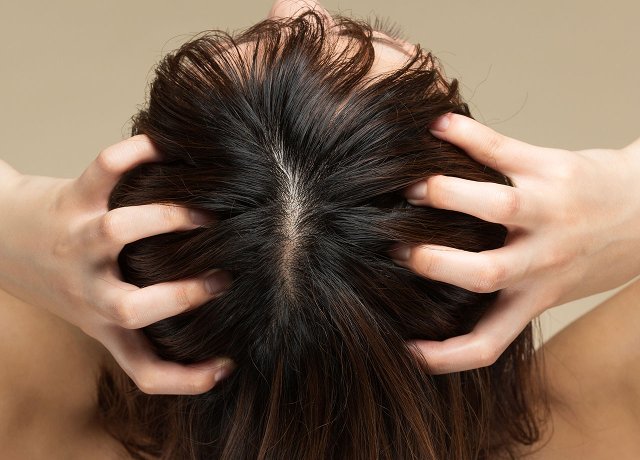 woman-healthy-scalp