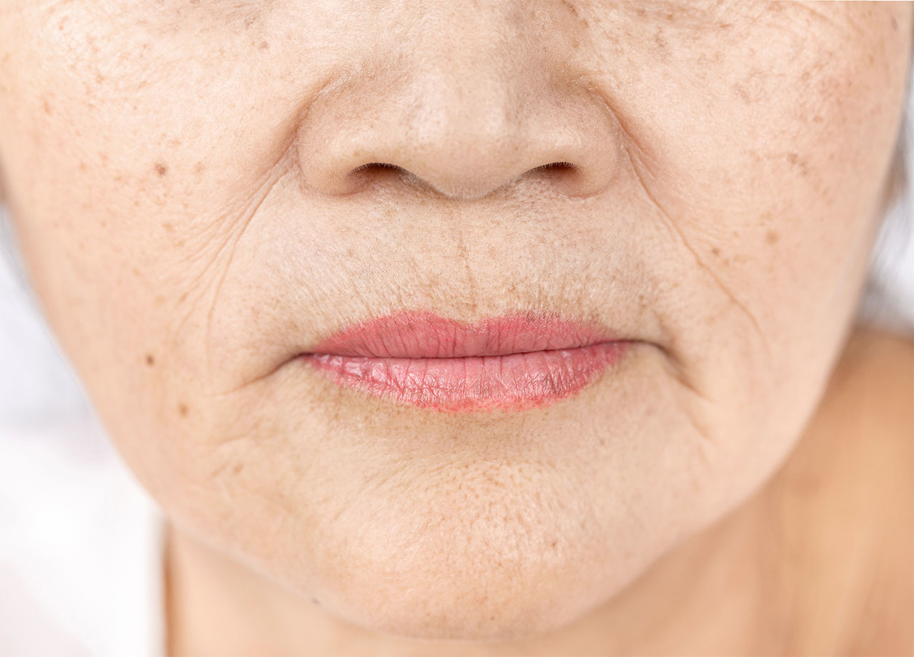 older-woman-wrinkled-lips