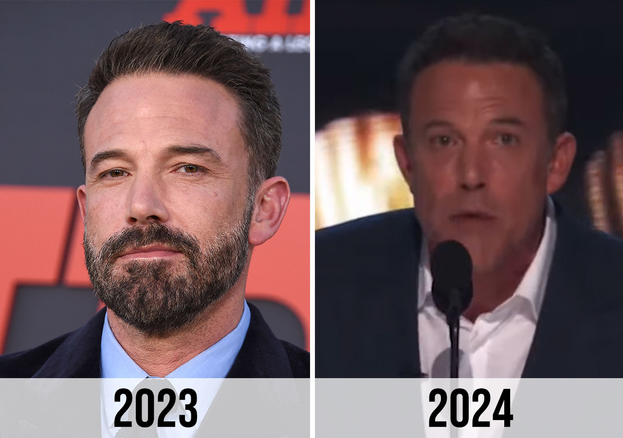 Fans Think Ben Affleck Had Bad ‘Plastic Surgery’ After His Appearance ...