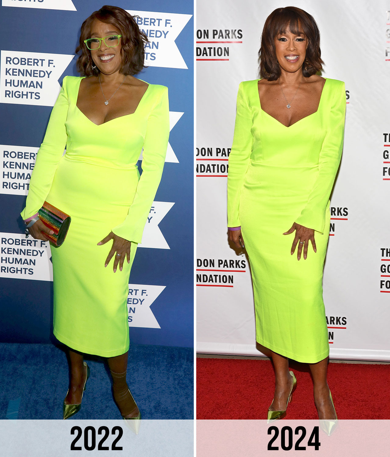 Gayle King Before and after 2022/2024