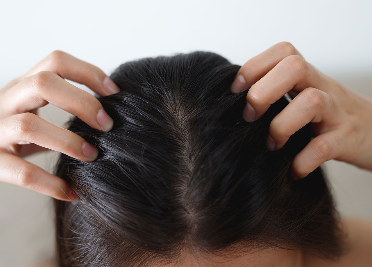 woman-healthy-scalp