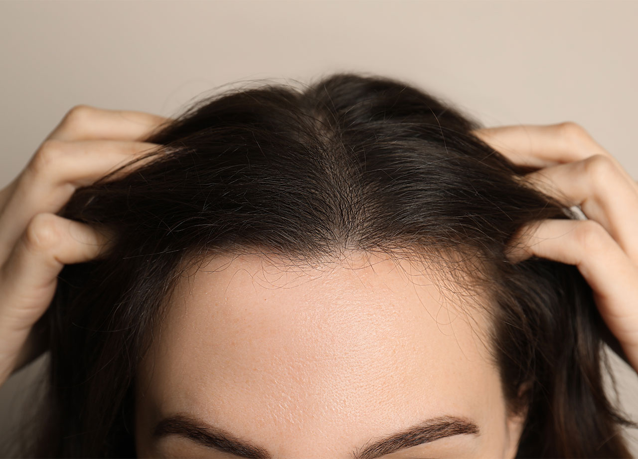 woman-scalp-healthy-hair