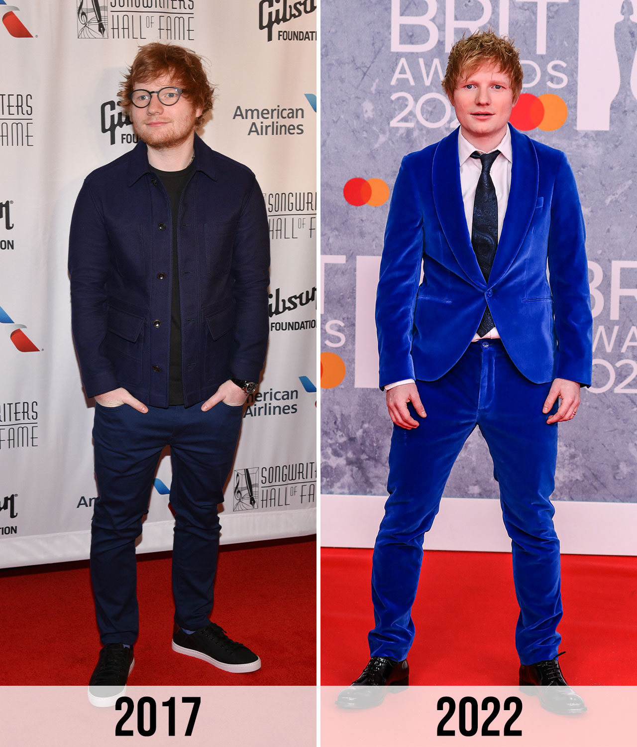 Ed Sheeran before and after weight loss 2017 vs 2022