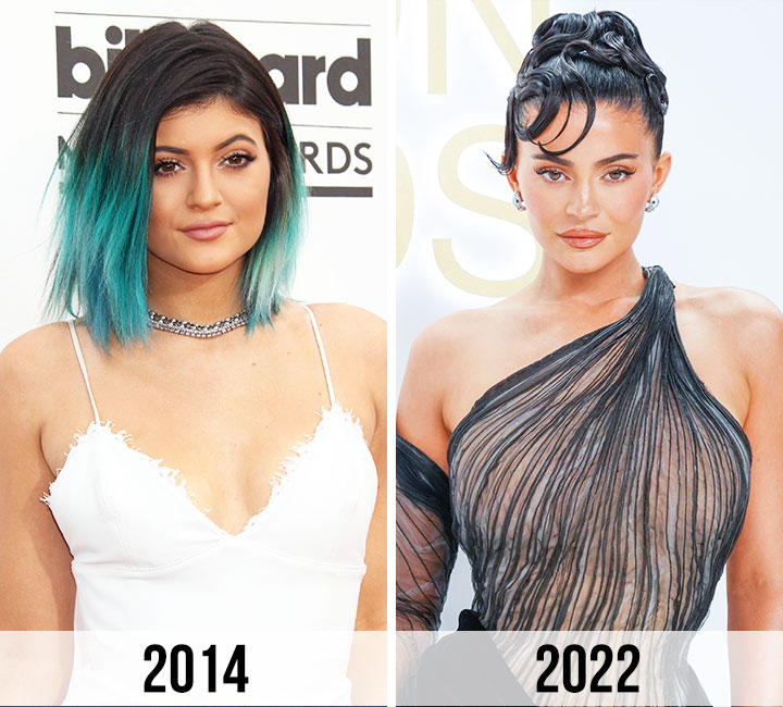 Kylie Jenner before and after breast enlargement 2014 vs 2022