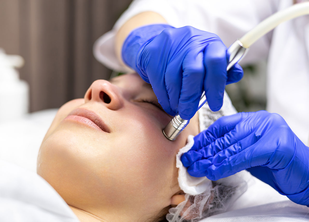 woman-getting-microneedling