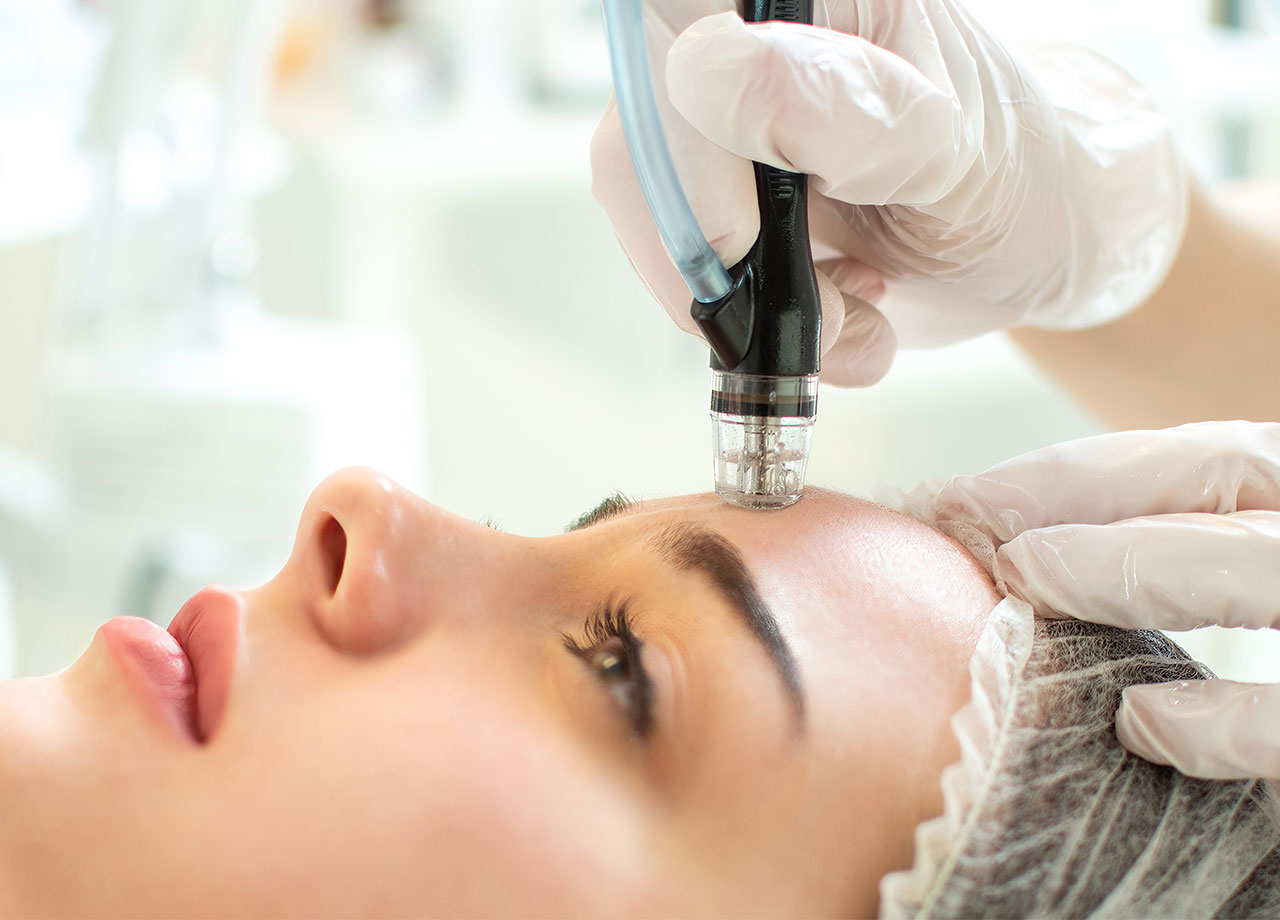 woman-getting-microdermabrasion