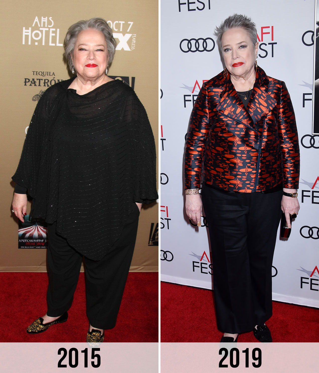 Kathy Bates weight loss transformation 2015 to 2019